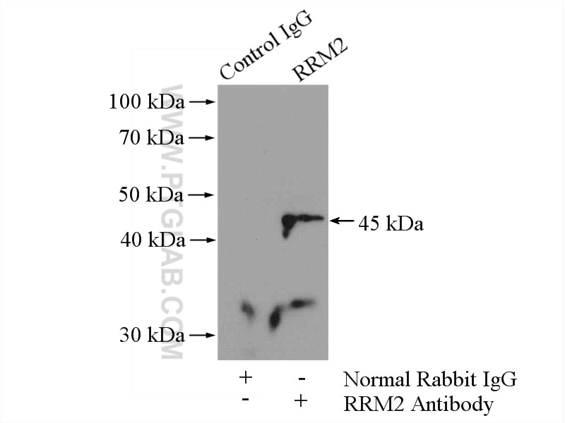 Immunoprecipitation (IP) experiment of K-562 cells using RRM2 Polyclonal antibody (11661-1-AP)