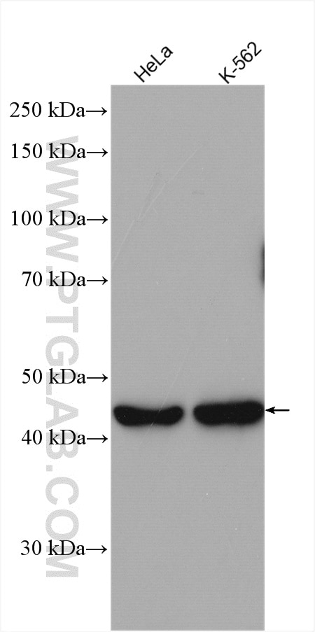 Western Blot (WB) analysis of various lysates using RRM2 Polyclonal antibody (11661-1-AP)