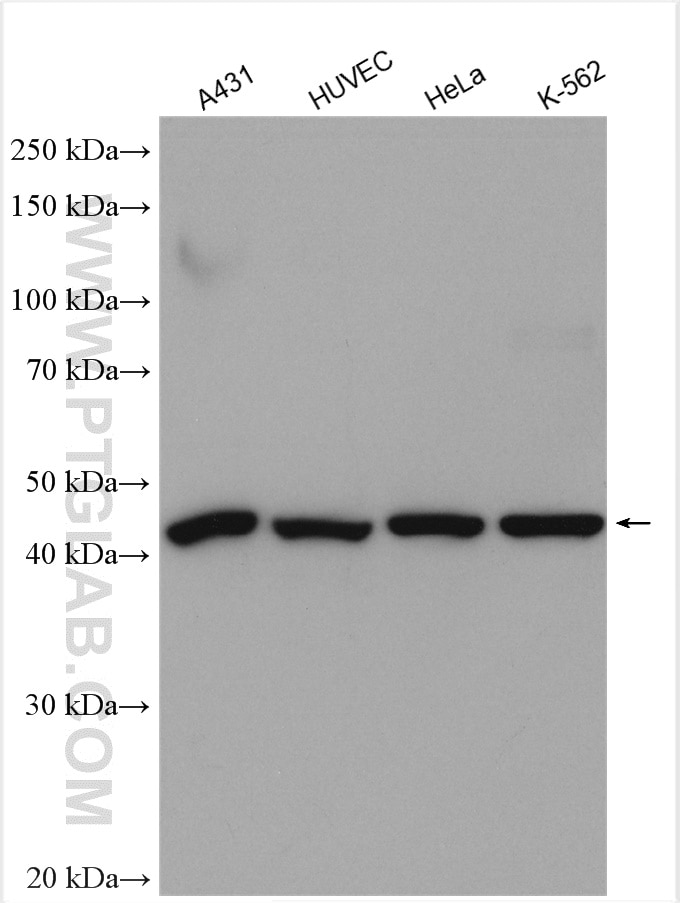 Western Blot (WB) analysis of various lysates using RRM2 Polyclonal antibody (11661-1-AP)