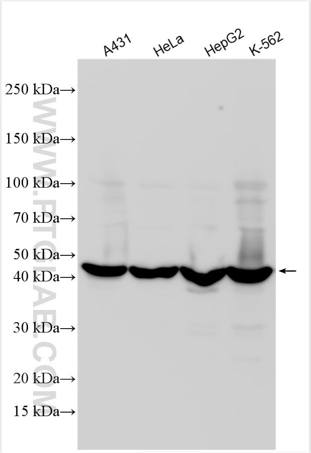 Western Blot (WB) analysis of various lysates using RRM2 Polyclonal antibody (11661-1-AP)