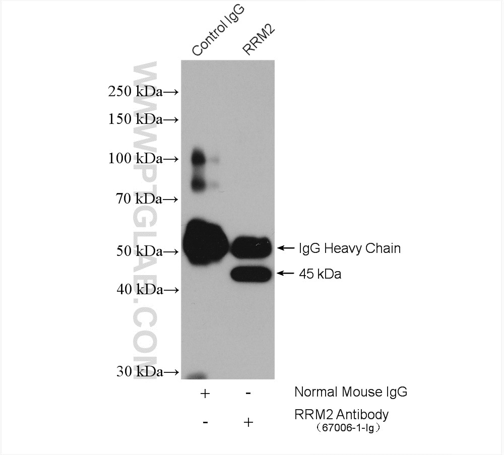 Immunoprecipitation (IP) experiment of HEK-293 cells using RRM2 Monoclonal antibody (67006-1-Ig)