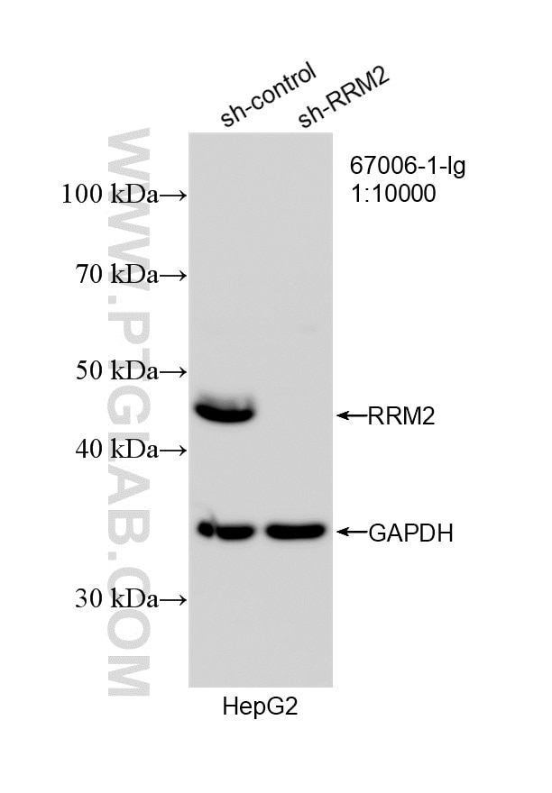 WB analysis of HepG2 using 67006-1-Ig Western Blot (WB) analysis of HepG2 cells using RRM2 Monoclonal antibody (67006-1-Ig)