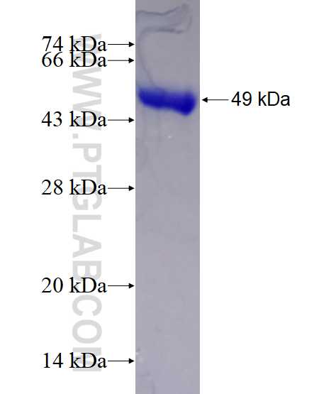 RRM2 fusion protein Ag28664 SDS-PAGE