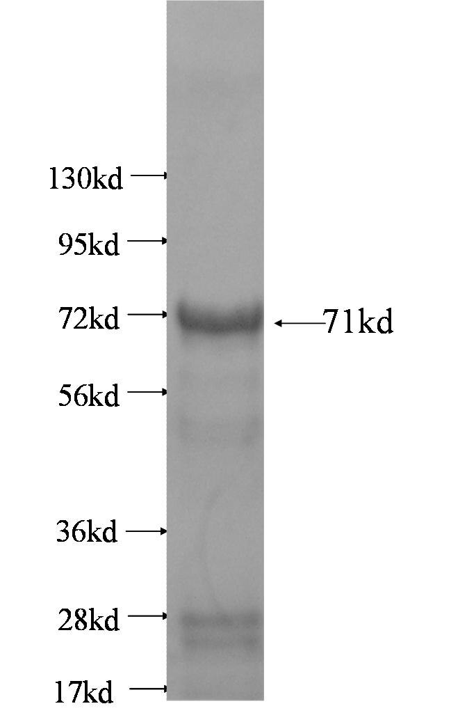 RRM2 fusion protein Ag2203 SDS-PAGE