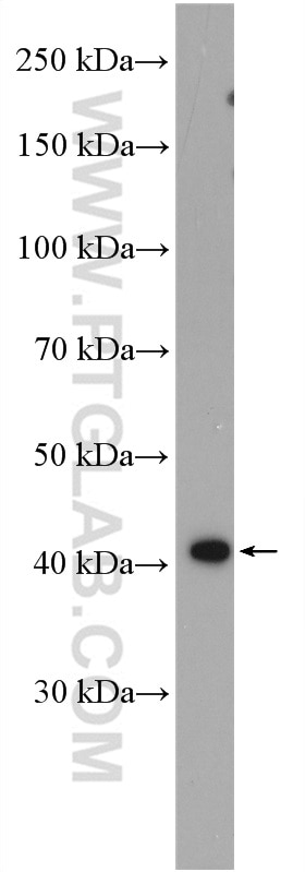 Western Blot (WB) analysis of HeLa cells using RRM2B,p53R2 Polyclonal antibody (18005-1-AP)