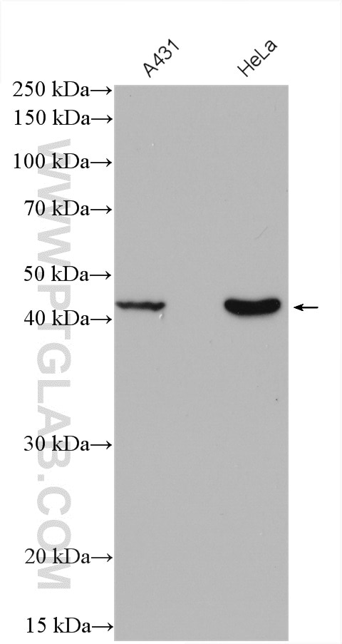 Western Blot (WB) analysis of various lysates using RRM2B,p53R2 Polyclonal antibody (18005-1-AP)
