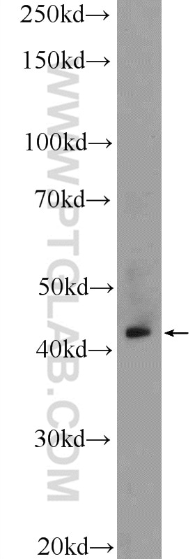 Western Blot (WB) analysis of PC-3 cells using RRM2B,p53R2 Polyclonal antibody (18005-1-AP)