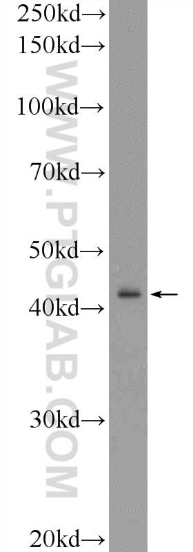 Western Blot (WB) analysis of MDA-MB-453s cells using RRM2B,p53R2 Polyclonal antibody (18005-1-AP)