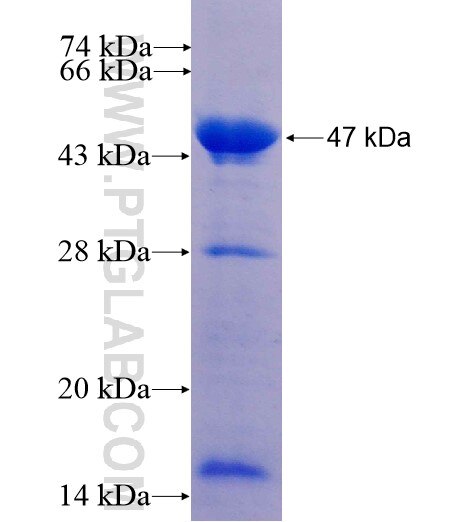 RRM2B,p53R2 fusion protein Ag12483 SDS-PAGE
