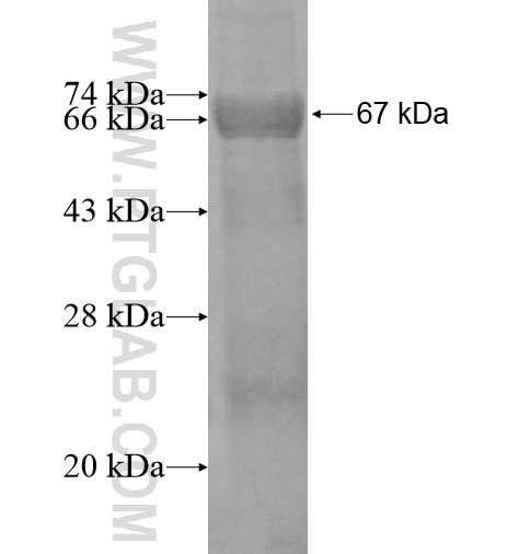 RRM2B,p53R2 fusion protein Ag12499 SDS-PAGE