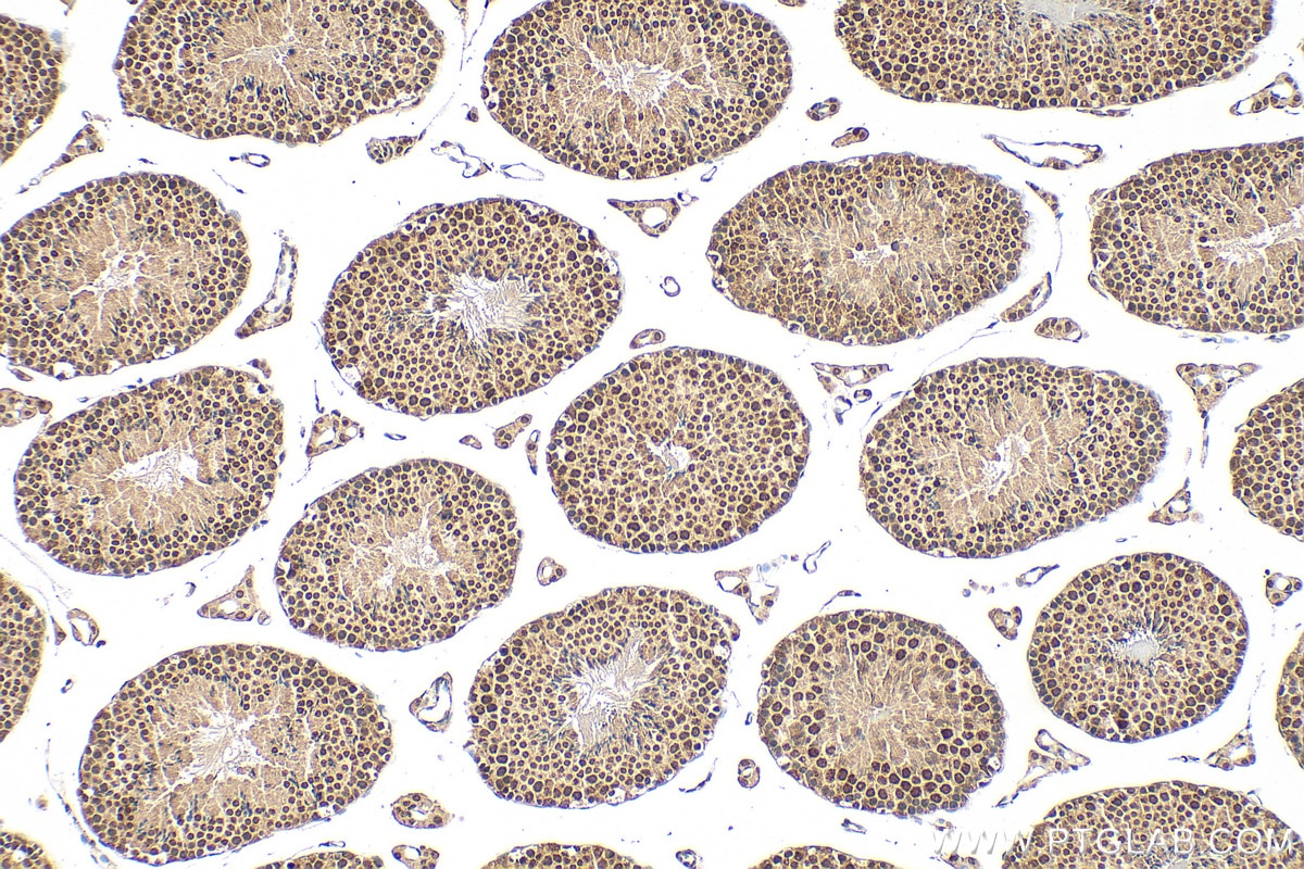 Immunohistochemistry (IHC) staining of mouse testis tissue using RRN3 Polyclonal antibody (25918-1-AP)