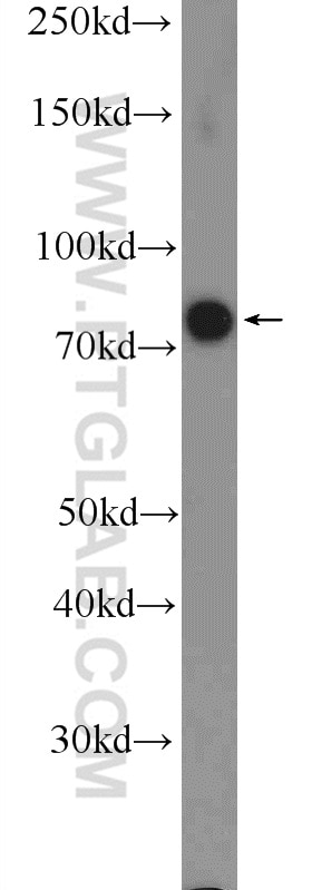 Western Blot (WB) analysis of HeLa cells using RRN3 Polyclonal antibody (25918-1-AP)