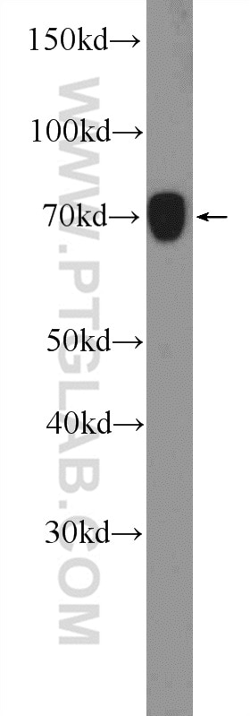 Western Blot (WB) analysis of Jurkat cells using RRN3 Polyclonal antibody (25918-1-AP)