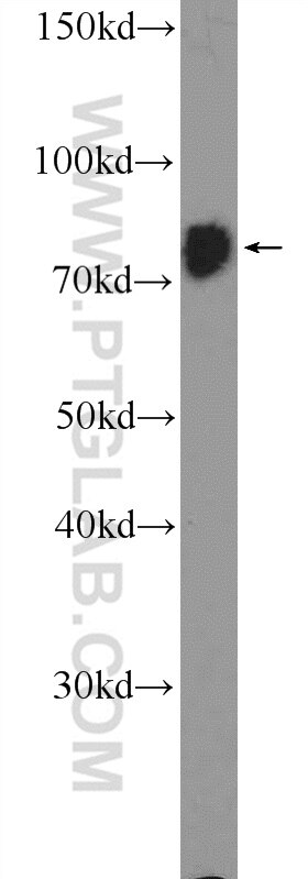 Western Blot (WB) analysis of K-562 cells using RRN3 Polyclonal antibody (25918-1-AP)