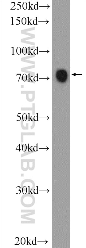 WB analysis of HeLa using 25918-1-AP