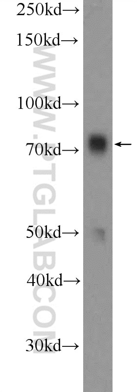 Western Blot (WB) analysis of mouse testis tissue using RRN3 Polyclonal antibody (25918-1-AP)