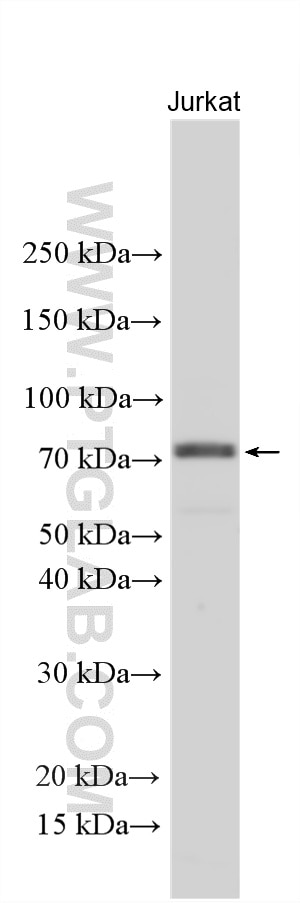 Western Blot (WB) analysis of various lysates using RRN3 Polyclonal antibody (25918-1-AP)