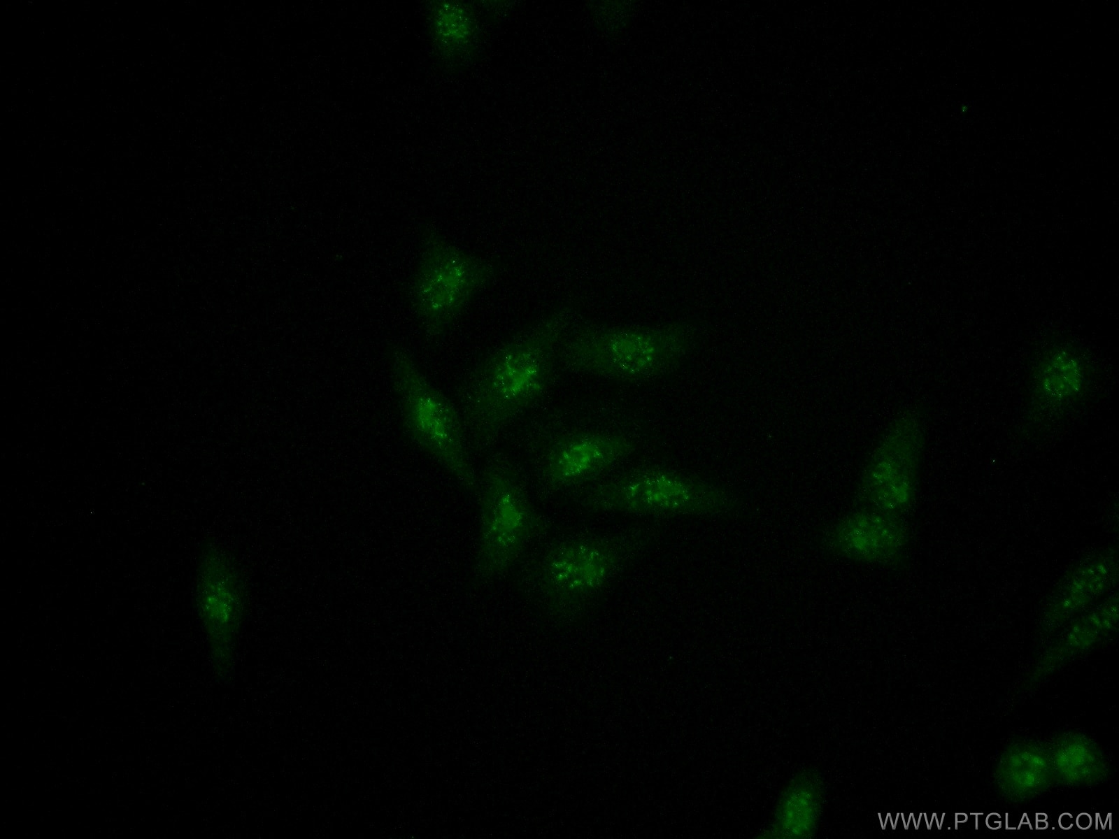 Immunofluorescence (IF) / fluorescent staining of HeLa cells using RRP1 Polyclonal antibody (14896-1-AP)