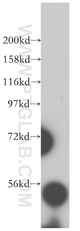 Western Blot (WB) analysis of HeLa cells using RRP1 Polyclonal antibody (14896-1-AP)