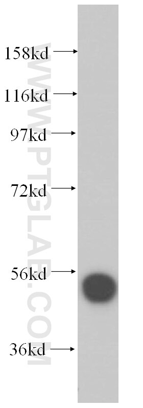 WB analysis of HEK-293 using 14896-1-AP