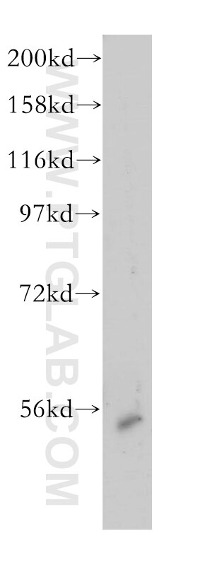 Western Blot (WB) analysis of human spleen tissue using RRP1 Polyclonal antibody (14896-1-AP)