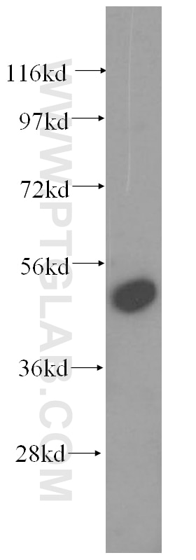 Western Blot (WB) analysis of HEK-293 cells using RRP1 Polyclonal antibody (14896-1-AP)