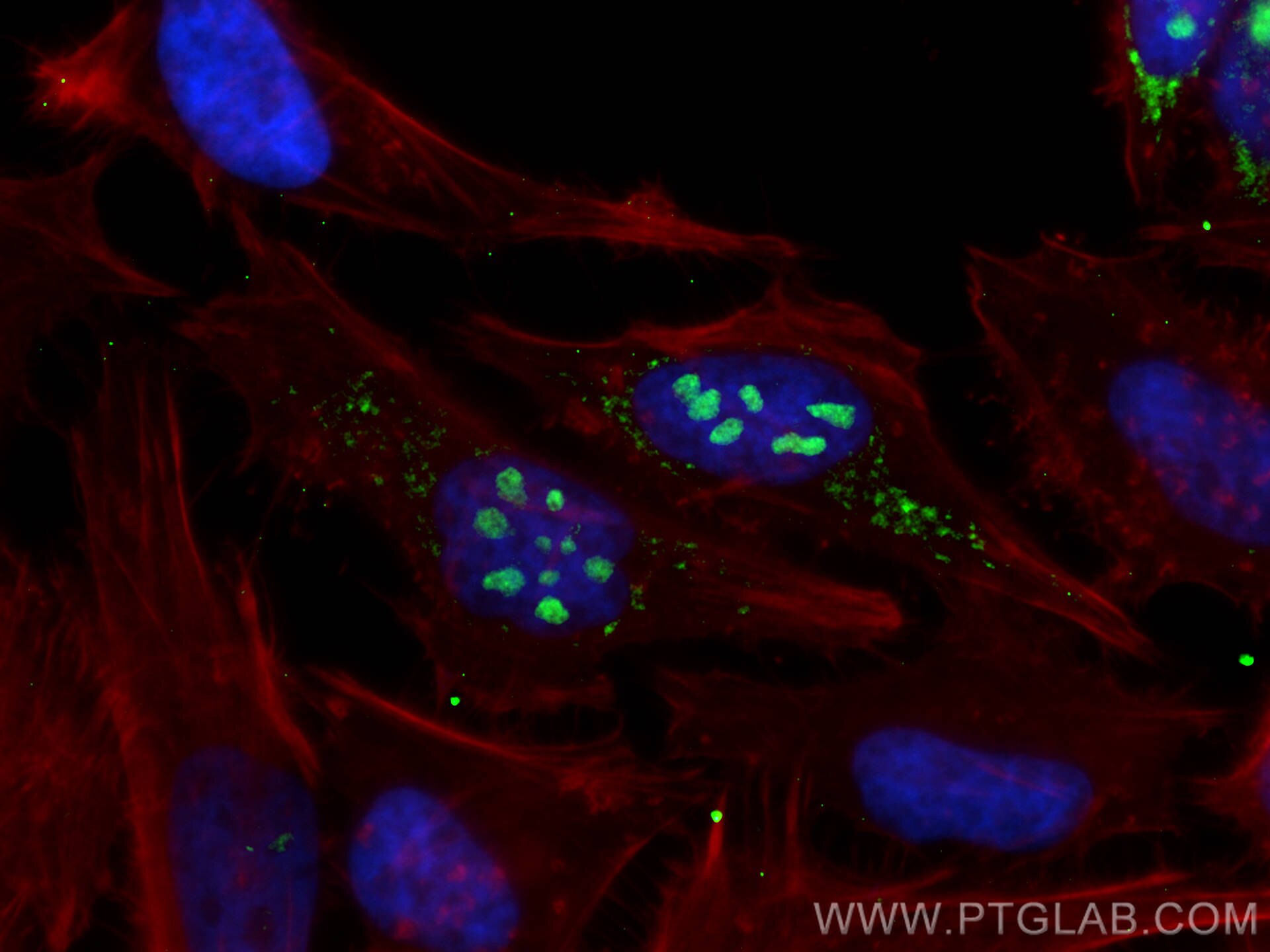 Immunofluorescence (IF) / fluorescent staining of HeLa cells using RRP12 Polyclonal antibody (26849-1-AP)