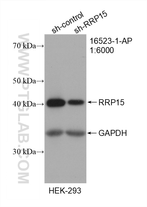 Western Blot (WB) analysis of HEK-293 cells using RRP15 Polyclonal antibody (16523-1-AP)