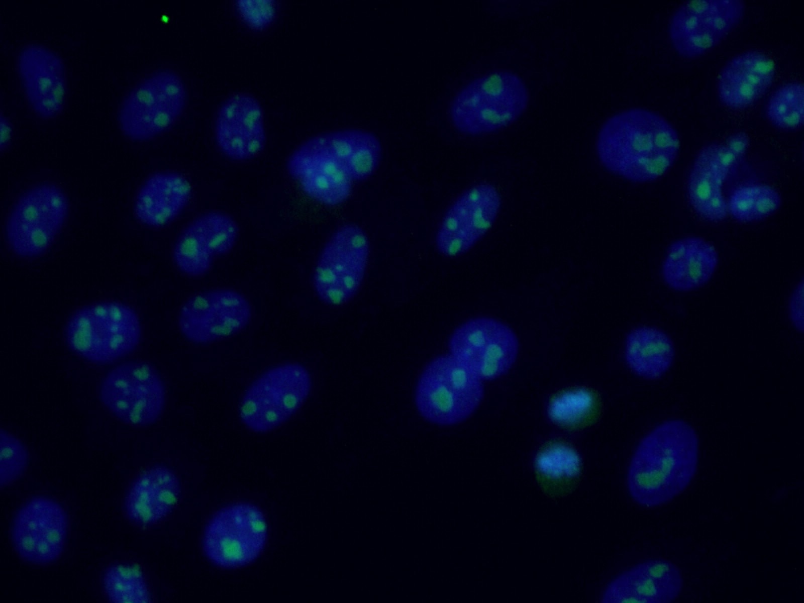 Immunofluorescence (IF) / fluorescent staining of A431 cells using RRP1B Polyclonal antibody (27723-1-AP)