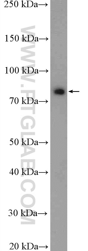 Western Blot (WB) analysis of HepG2 cells using RRP1B Polyclonal antibody (27723-1-AP)
