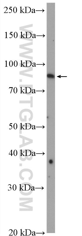 Western Blot (WB) analysis of HeLa cells using RRP1B Polyclonal antibody (27723-1-AP)