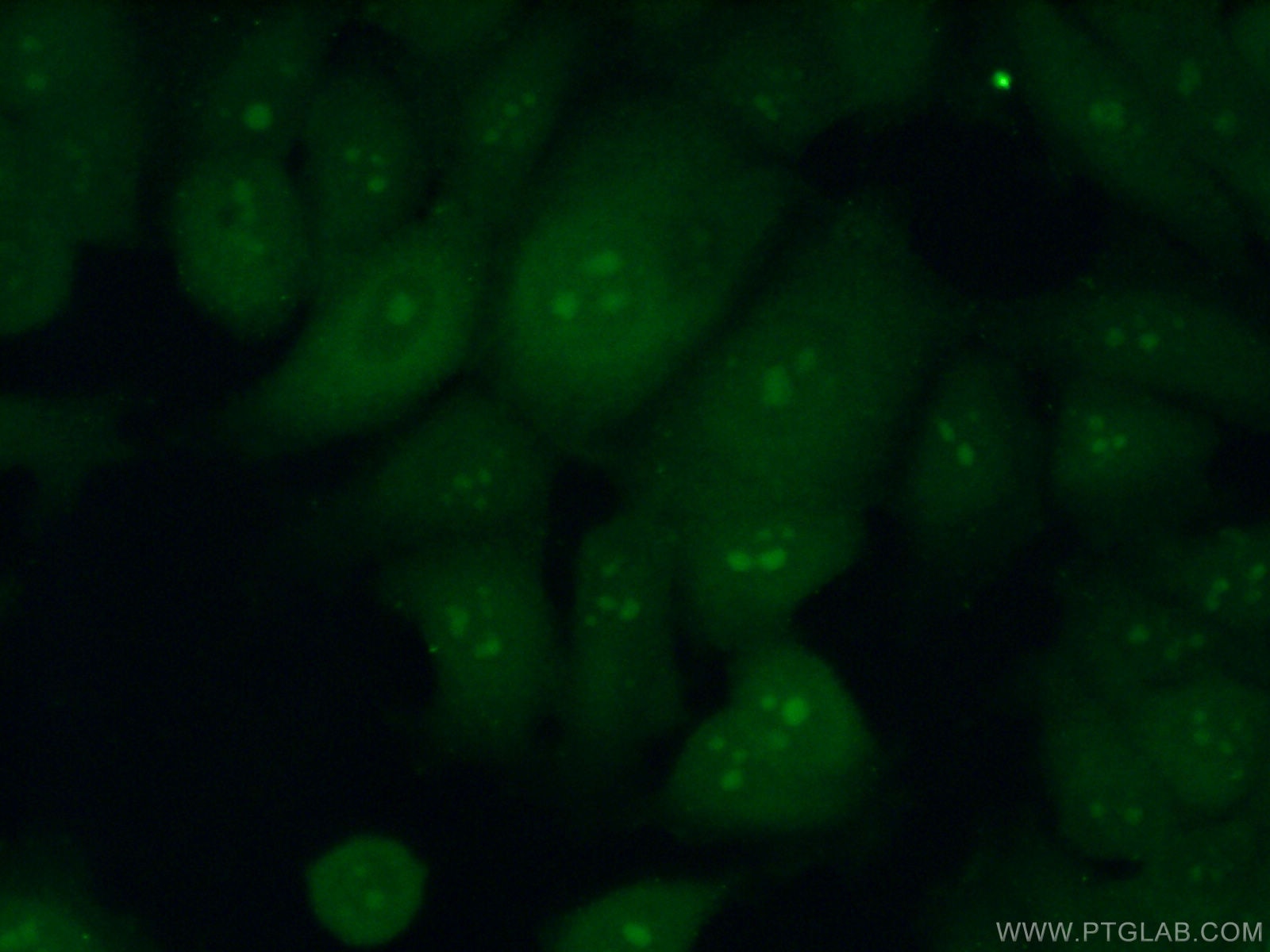 Immunofluorescence (IF) / fluorescent staining of MCF-7 cells using RRP36 Polyclonal antibody (25440-1-AP)