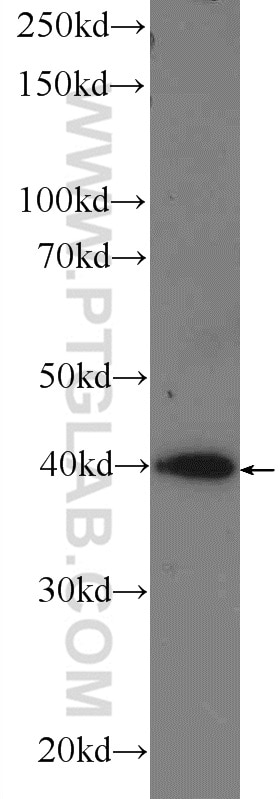 Western Blot (WB) analysis of MCF-7 cells using RRP36 Polyclonal antibody (25440-1-AP)