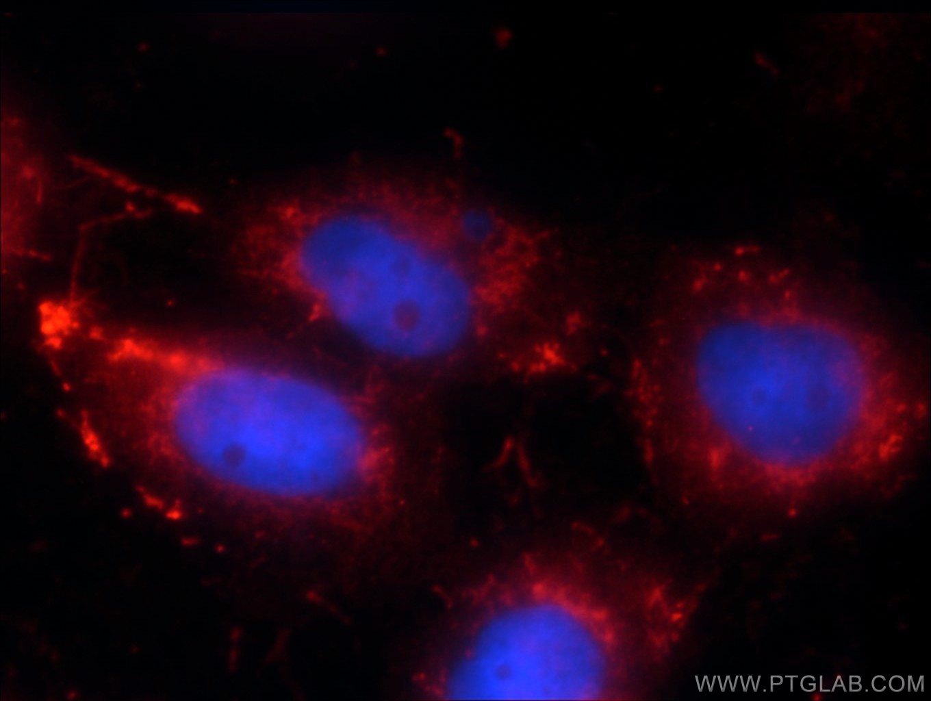 Immunofluorescence (IF) / fluorescent staining of A431 cells using RRP7A Polyclonal antibody (24490-1-AP)