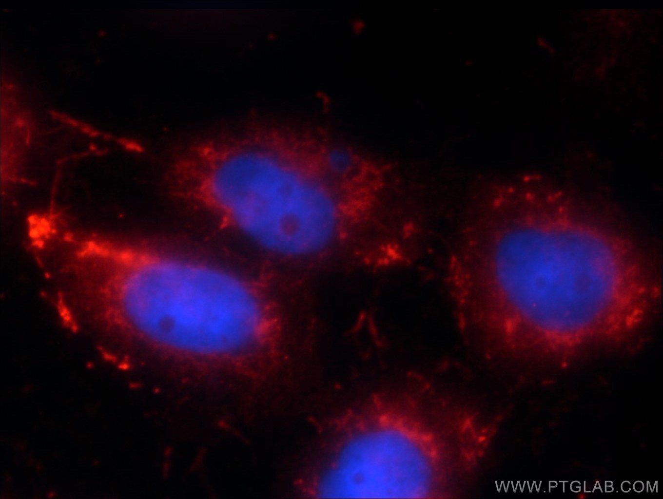 IF Staining of A431 using 24490-1-AP