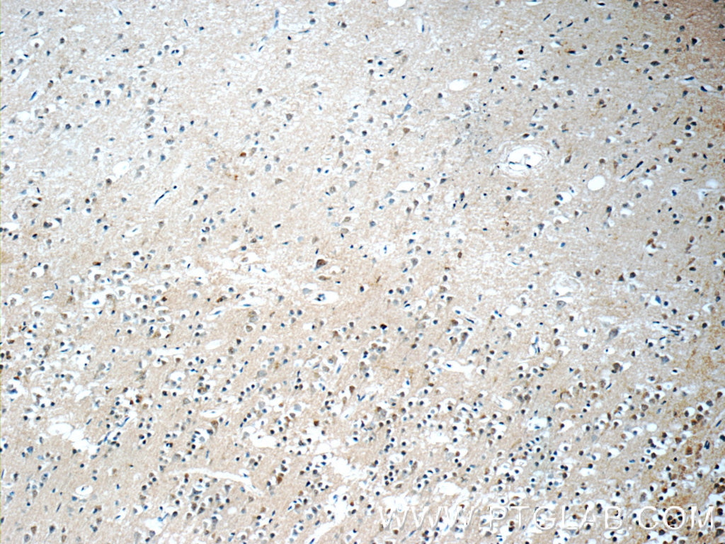 Immunohistochemistry (IHC) staining of human brain tissue using RRP7A Polyclonal antibody (24490-1-AP)