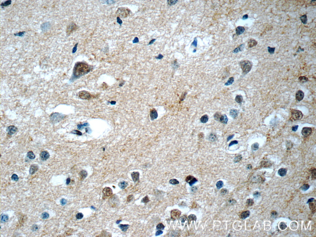 Immunohistochemistry (IHC) staining of human brain tissue using RRP7A Polyclonal antibody (24490-1-AP)
