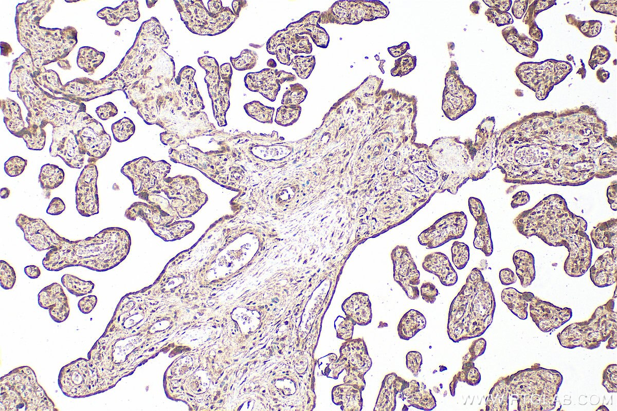 Immunohistochemistry (IHC) staining of human placenta tissue using RRP7A Polyclonal antibody (24490-1-AP)