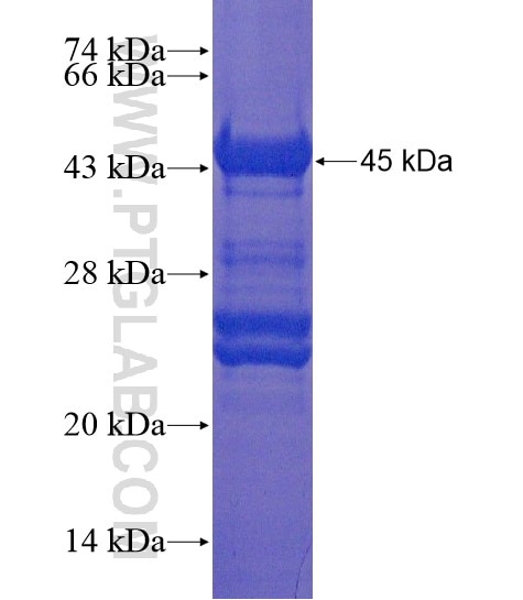 RRP7A fusion protein Ag21636 SDS-PAGE