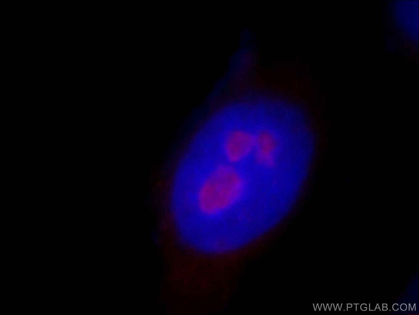 Immunofluorescence (IF) / fluorescent staining of HeLa cells using RRP8 Polyclonal antibody (20129-1-AP)
