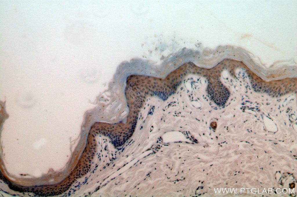 Immunohistochemistry (IHC) staining of human skin tissue using RRP8 Polyclonal antibody (20129-1-AP)