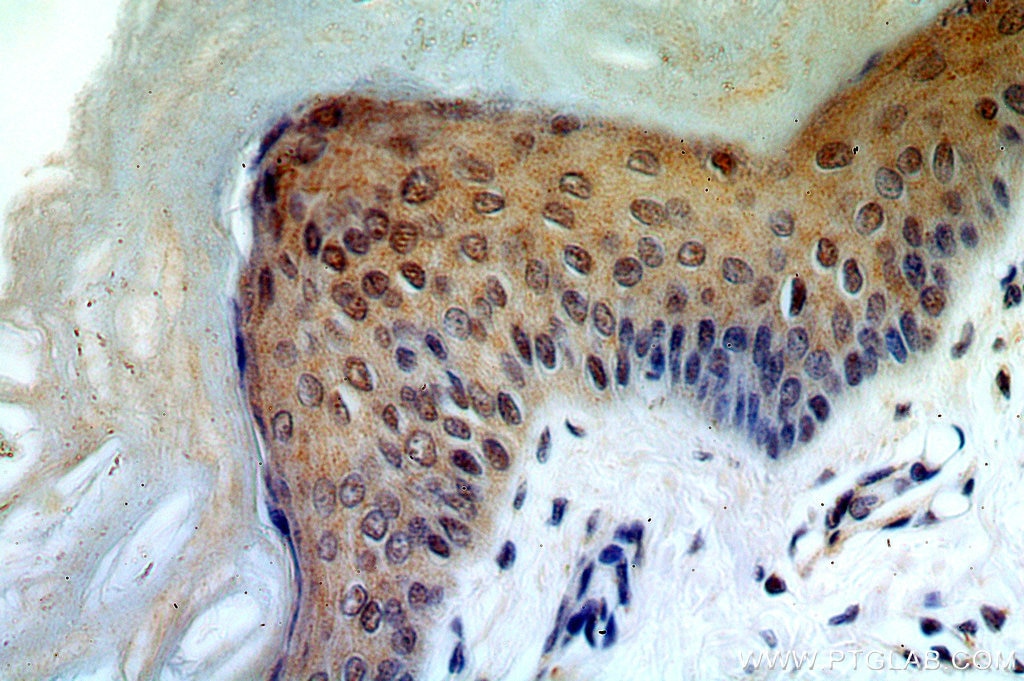Immunohistochemistry (IHC) staining of human skin tissue using RRP8 Polyclonal antibody (20129-1-AP)
