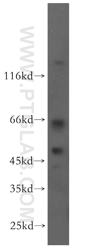 Western Blot (WB) analysis of human brain tissue using RRP8 Polyclonal antibody (20129-1-AP)