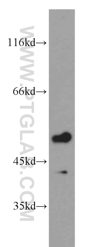 Western Blot (WB) analysis of human brain tissue using RRP8 Polyclonal antibody (20129-1-AP)