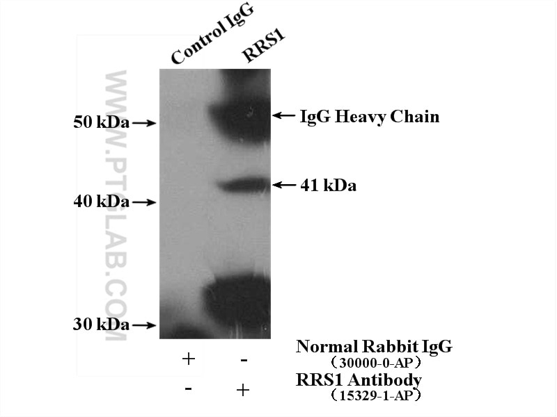 Immunoprecipitation (IP) experiment of K-562 cells using RRS1 Polyclonal antibody (15329-1-AP)