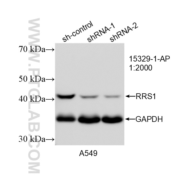 WB analysis of A549 using 15329-1-AP (same clone as 15329-1-PBS) Western Blot (WB) analysis of A549 cells using RRS1 Polyclonal antibody (15329-1-AP)
