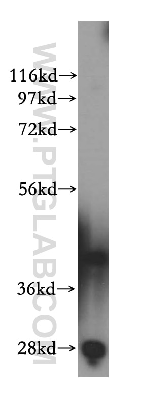 Western Blot (WB) analysis of HeLa cells using RRS1 Polyclonal antibody (15329-1-AP)