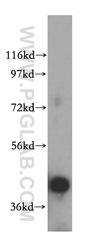 Western Blot (WB) analysis of K-562 cells using RRS1 Polyclonal antibody (15329-1-AP)