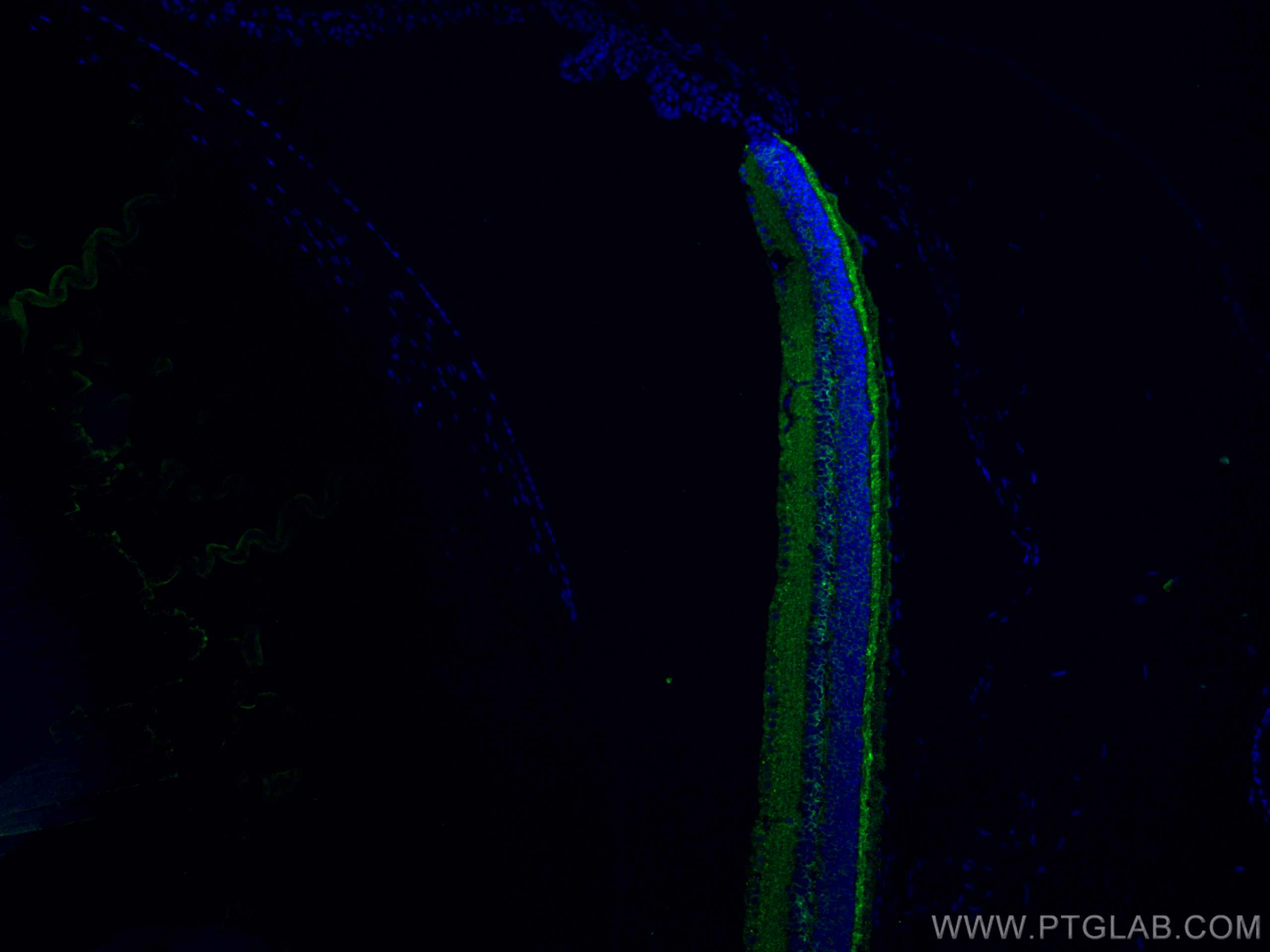 IF Staining of mouse eye using 24430-1-AP