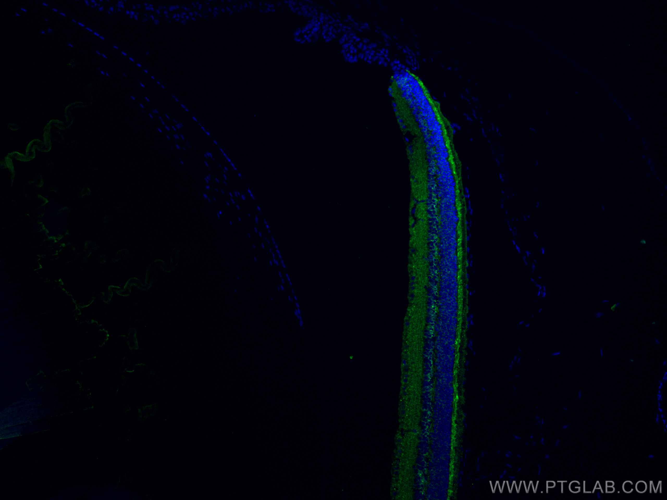 Immunofluorescence (IF) / fluorescent staining of mouse eye tissue using RS1 Polyclonal antibody (24430-1-AP)